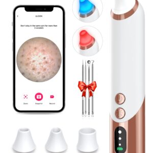 Xamoca Blackhead Remover Pore Vacuum